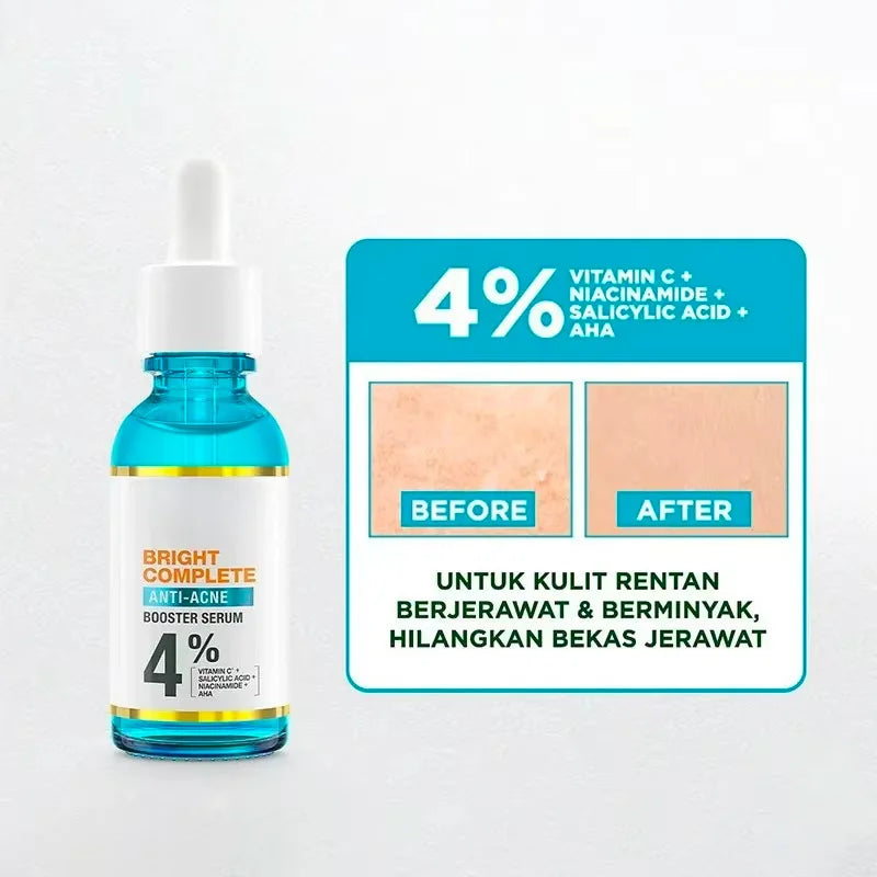 Sérum Visage Blanchissant 30ml – Anti-Acné, Anti-Points Noirs & Resserrant les Pores