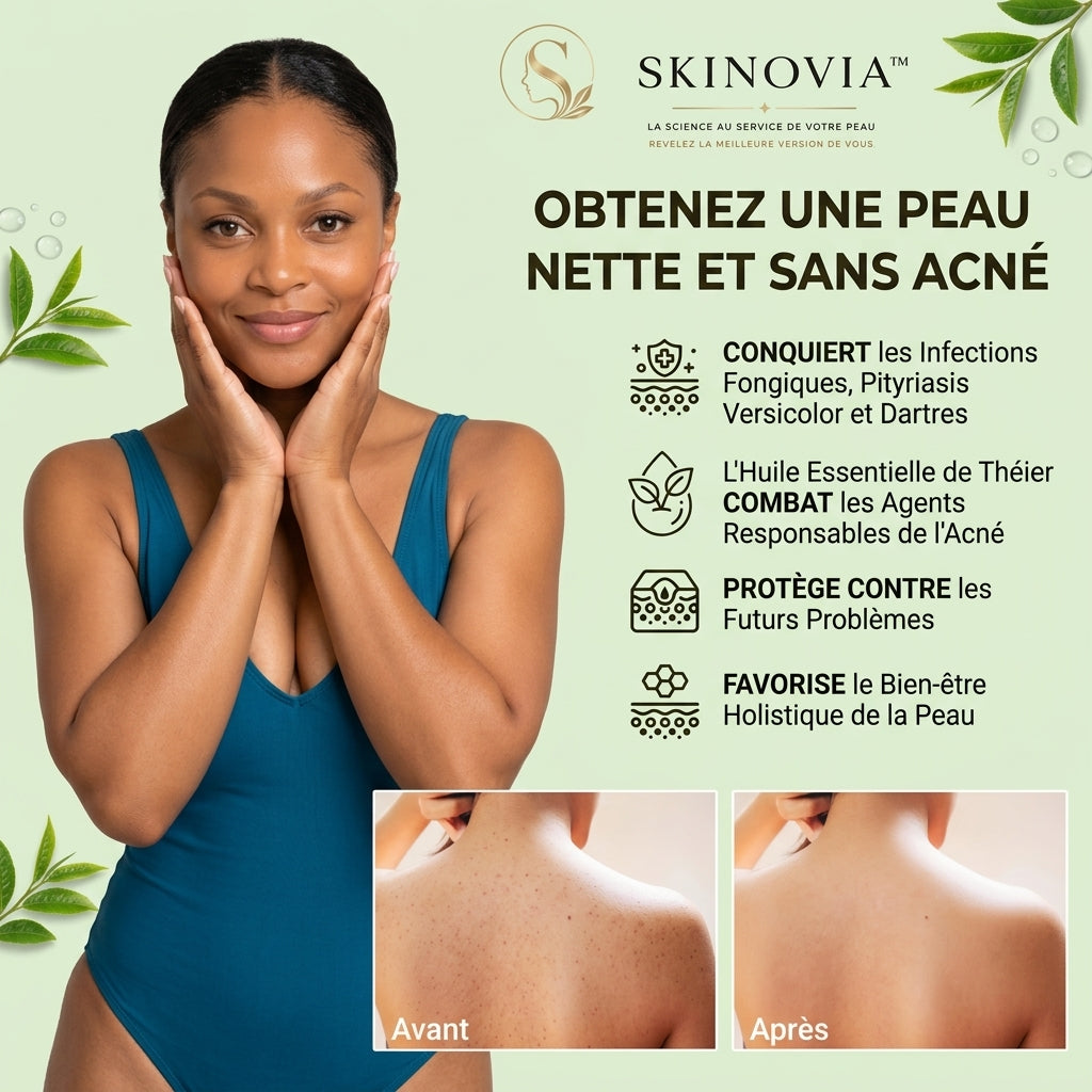 Tea Tree Soap for Sensitive Skin – Purifying, Hydrating, and Blemish-Fighting Care
