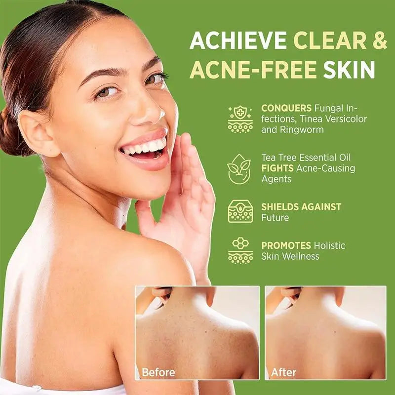Savon au Tea Tree pour Peaux Sensibles – Soin Purifiant, Hydratant et Anti-Imperfections
