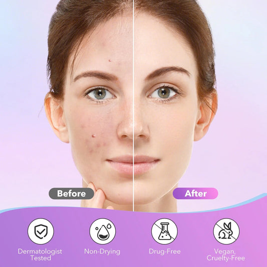 Patchs Anti-Acné Hydrocolloïdes – Boutons & Imperfections, Peau Sensible