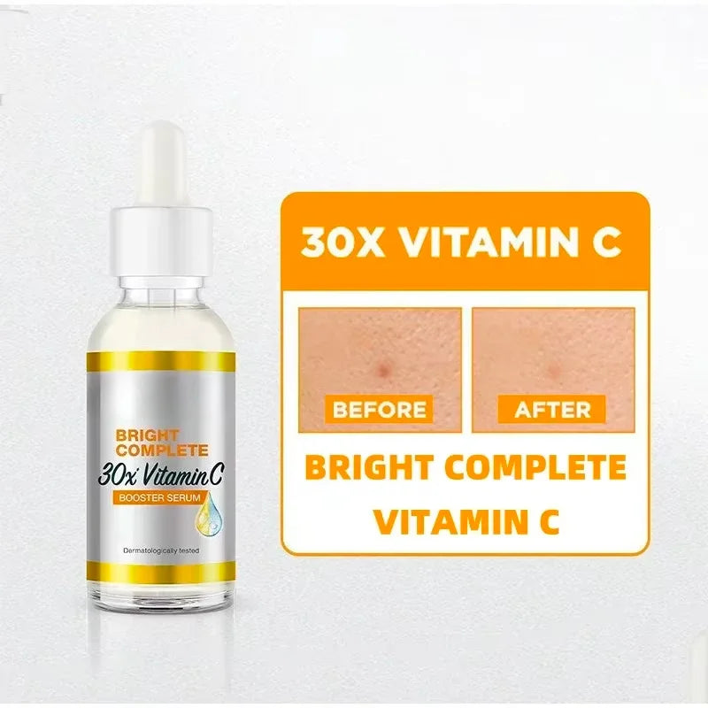Sérum Visage Blanchissant 30ml – Anti-Acné, Anti-Points Noirs & Resserrant les Pores